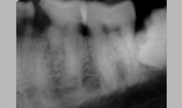 Oral surgery in Anand                        