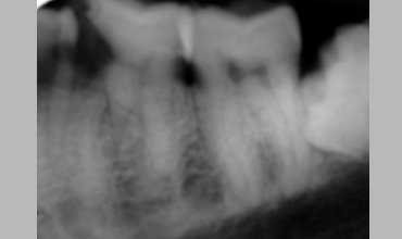 Best dentists in Anand                        