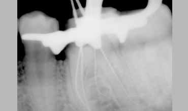 Orthodontic services in Anand                        