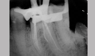 Dental hospital in Anand                        